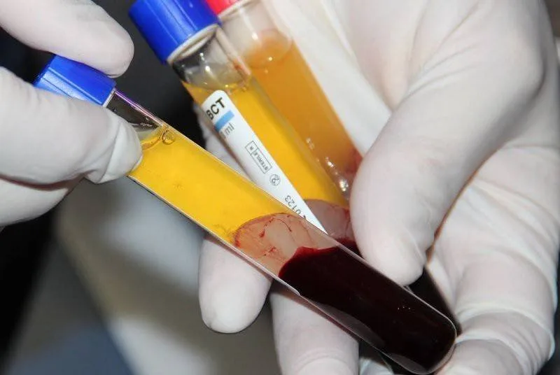 The Shameful Act of Selling Plasma in Pakistan