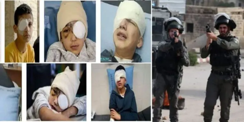 Palestine condemned brutal Israeli action in East Jerusalem