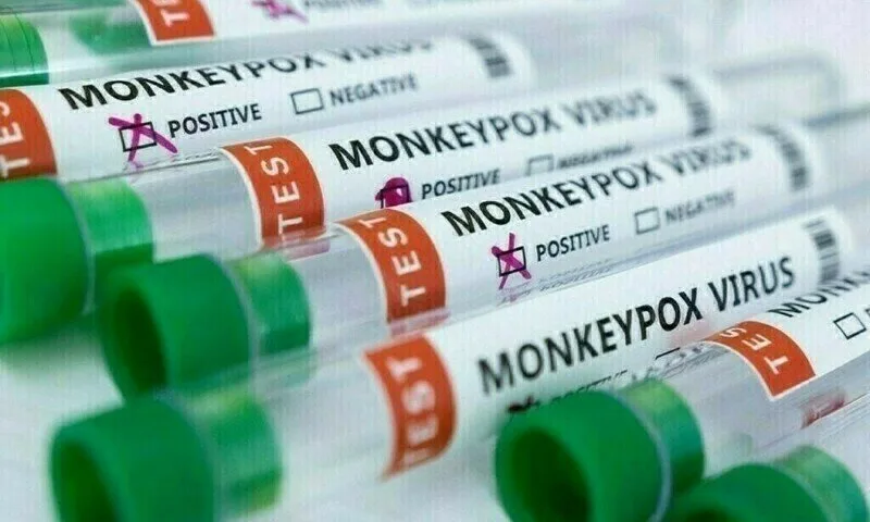 Monkey Pox
