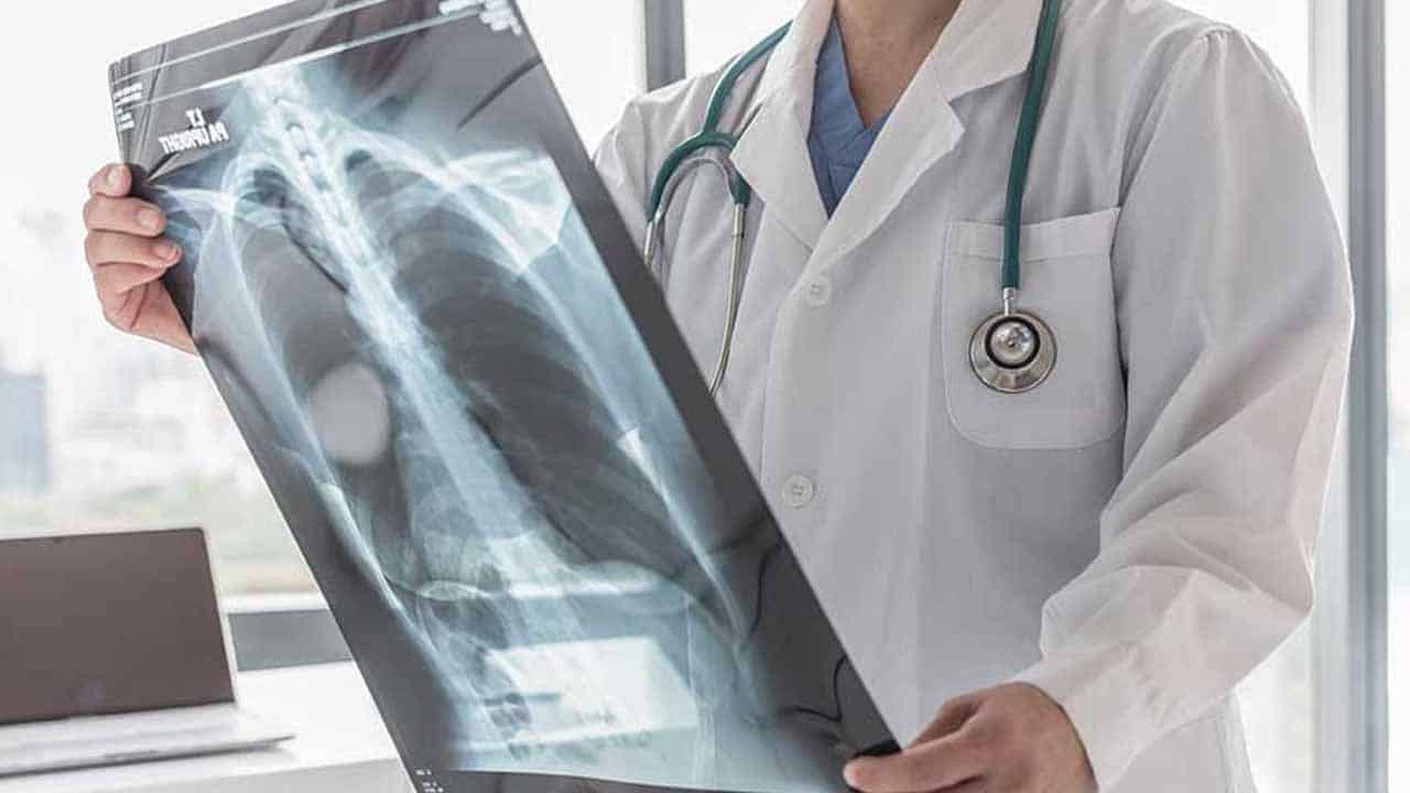 Pakistan may face a shortage of x-ray films, warns importer
