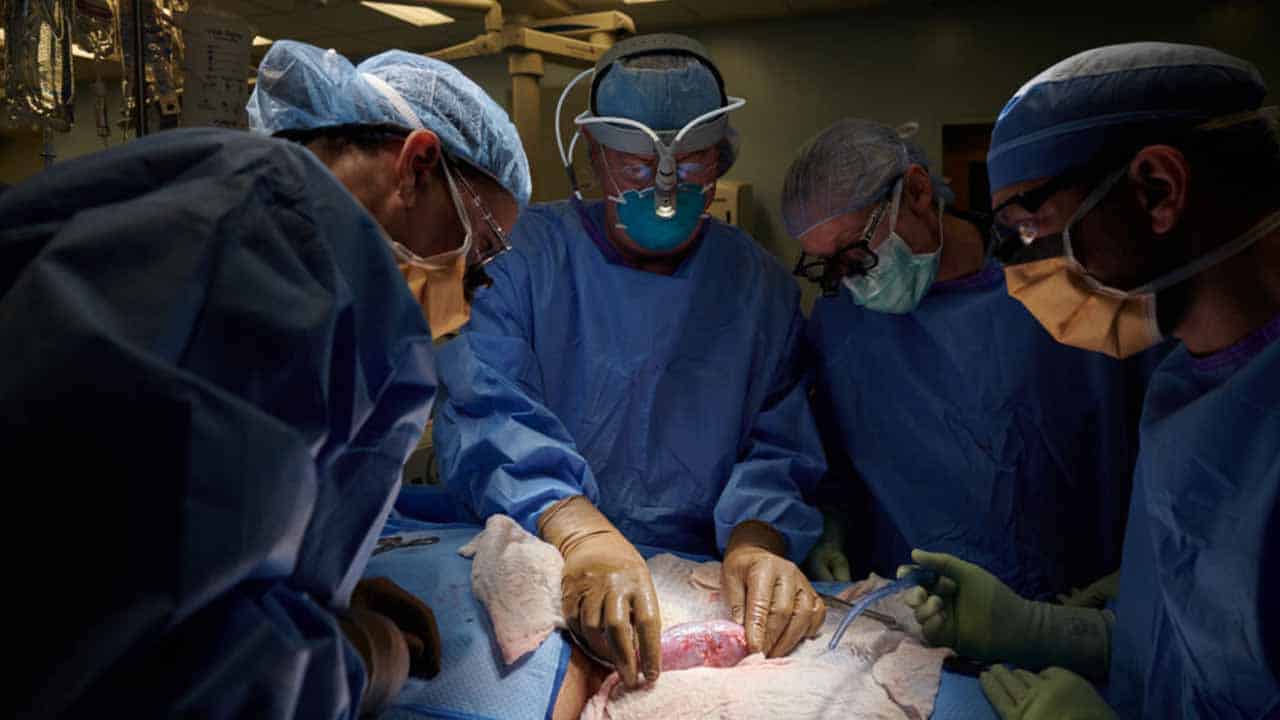 US surgeons mark achievement as pig kidney survives in human over a month